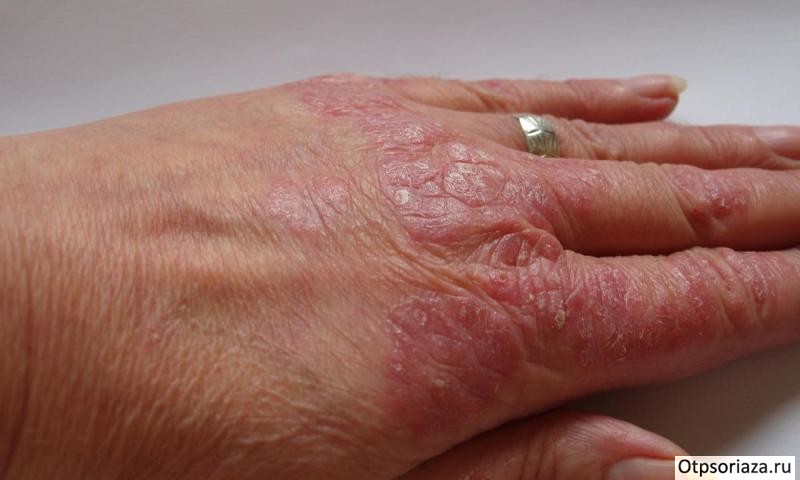 Барбера Барбера