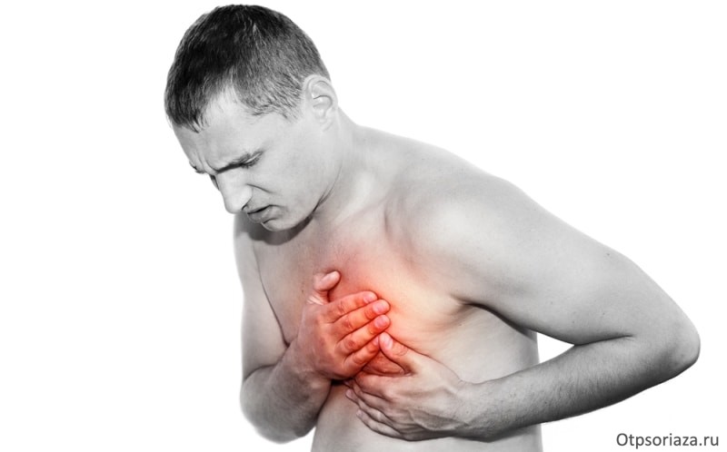 Сердечное заболевание Сердечное заболевание