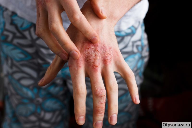 Терминальная пленка Терминальная пленка