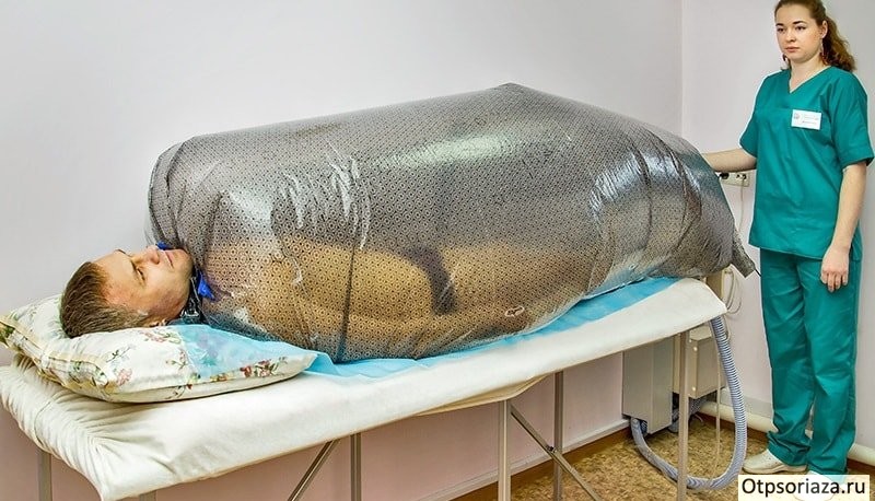 Углекислые ванны при псориазе Углекислая ванна при псориазе