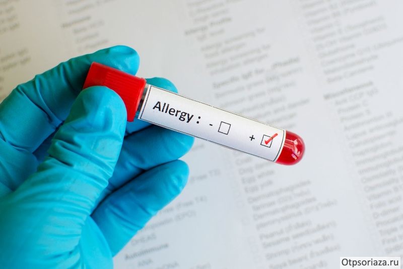 аллергены Аллергены