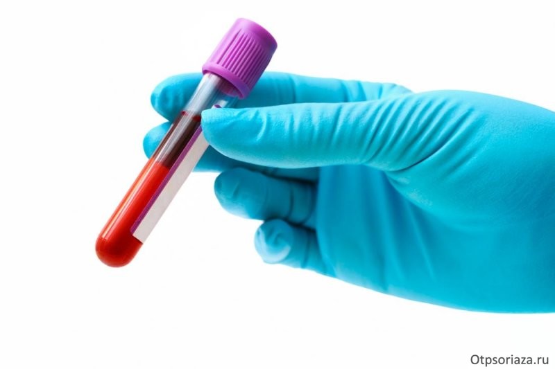 анализ крови Анализ крови