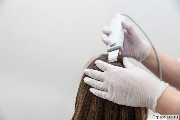 диагоностика Диагностика псориаза