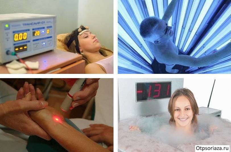 Физиотерапевтические методы Электросон, Puva-терапия, Лазеротерапия и Криотерапия
