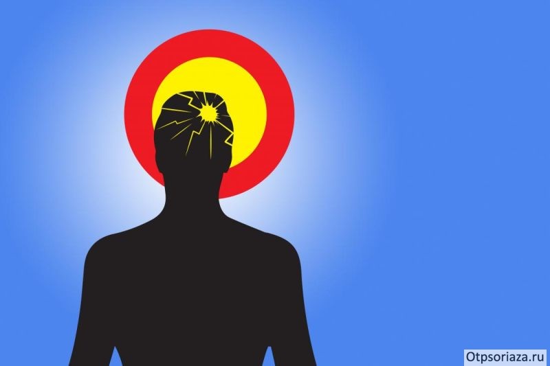 инсульт Инсульт