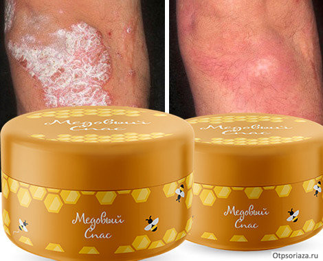 медовый спас Медовый спас