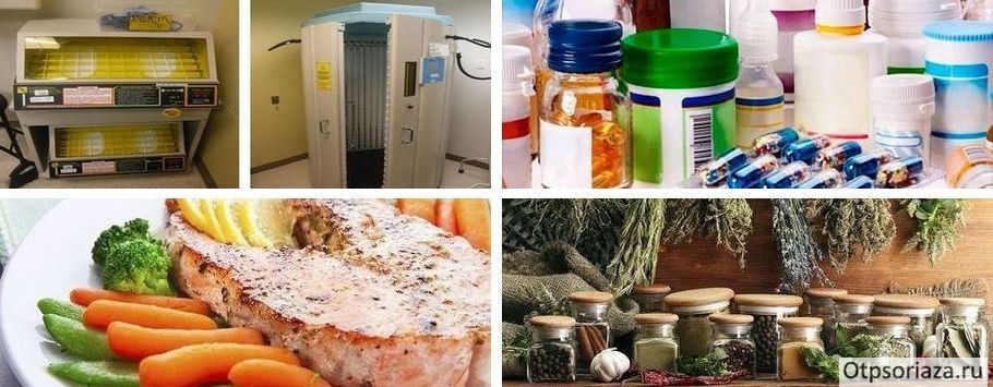 Методы лечения псориаза четыре подхода к лечению псориаза