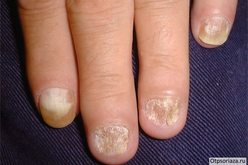 ногтевые-пластины Ногтевые пластины