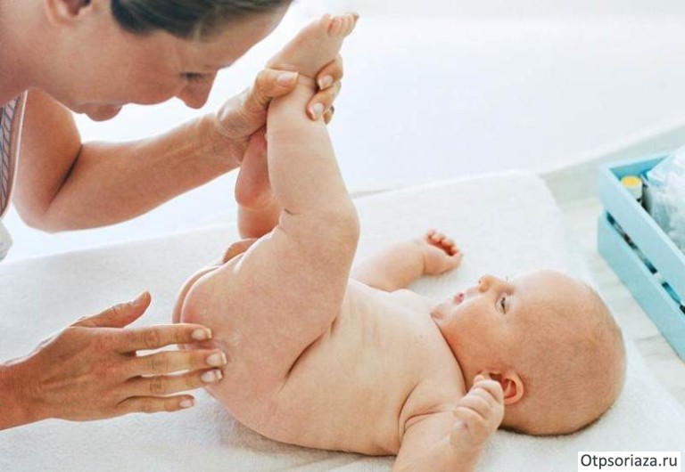 Симптомы псориаза Симптомы псориаза