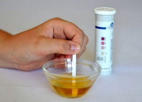 Тест полоски для определения ацетона Тест полоски для определения ацетона