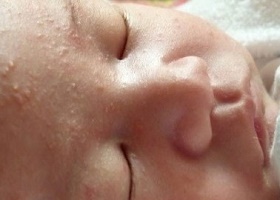 У детей У детей