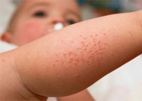 У детей У детей