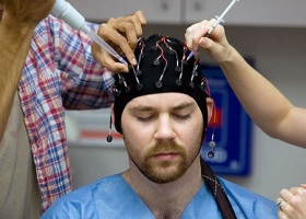 Диагностика эпилепсии Диагностика эпилепсии