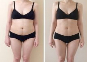 Фото до и после яичной диеты Магги Фото до и после яичной диеты Магги