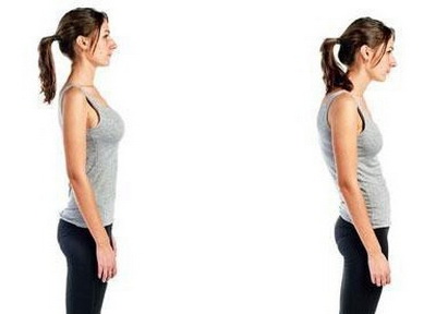 Сутулость, фото справа Сутулость, фото справа