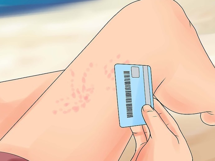 Удаление стрекал кредитной картой