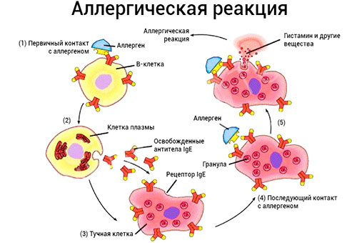Аллергический дерматит Аллергический дерматит
