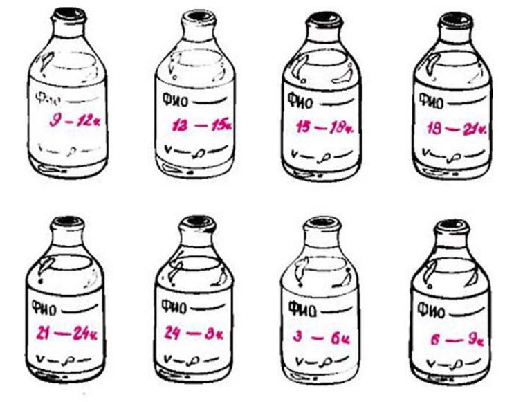 Анализ мочи по Зимницкому (проба Зимницкого) Анализ мочи по Зимницкому (проба Зимницкого)