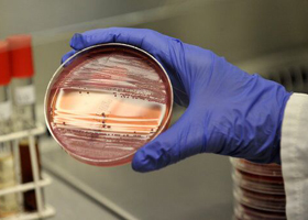 Диагностика кишечной палочки Диагностика кишечной палочки