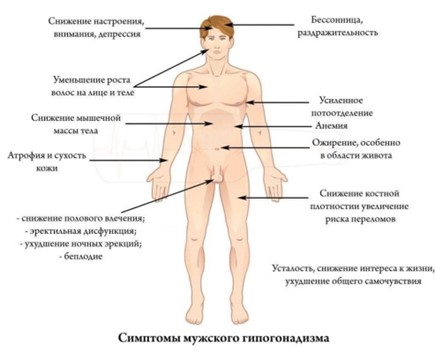 Андрогенный дефицит Андрогенный дефицит
