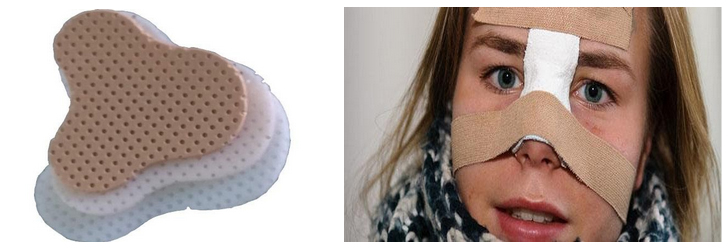 belkovo-energeti…-nedostatochnost 5 Перелом костей черепа