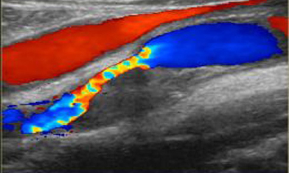 Изображение результата цветового сканирования Изображение результата цветового сканирования