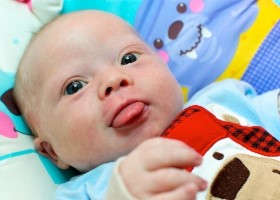 Фото признаков синдрома Дауна у новорожденных