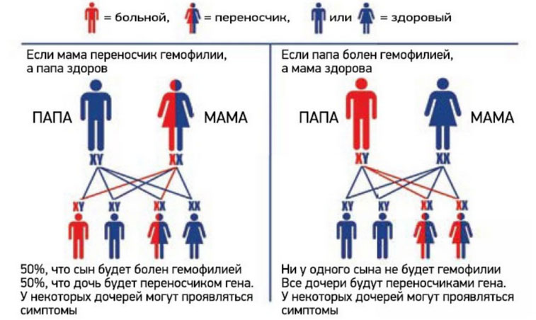 gemofiliya sxema Гемофилия