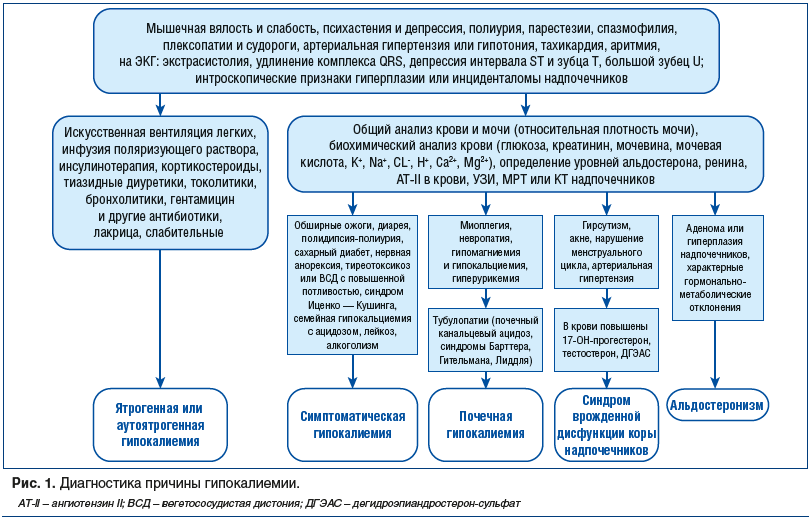 gipokaliemiya-ne…liya-v-organizme sxema Гипокалиемия (нехватка калия в организме)
