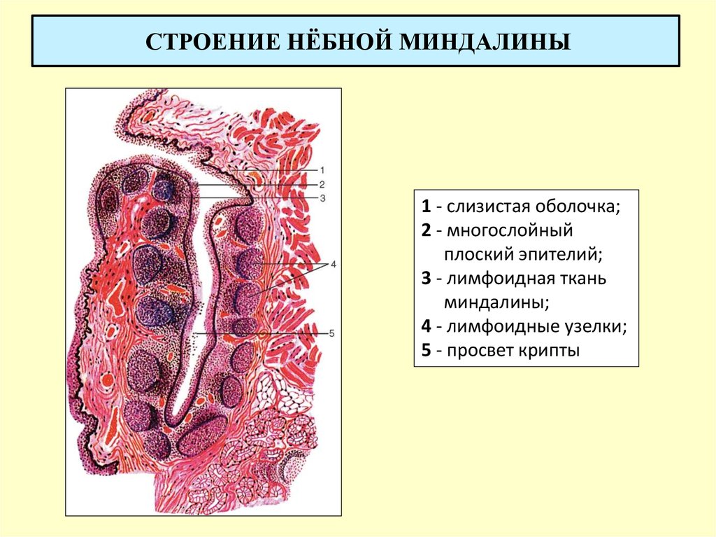 gnojnye-probki-b…ichenie-mindalin stroeinie Гнойные пробки, белый налет, воспаление и увеличение миндалин