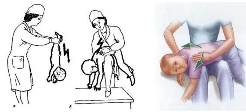 kashel-u-grudnichka 1 Кашель у грудничка