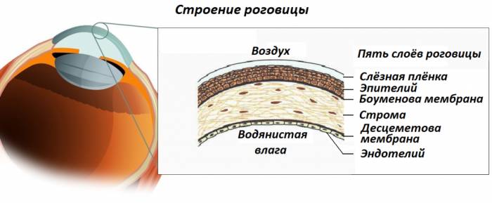 keratopatiya 2 Кератопатия