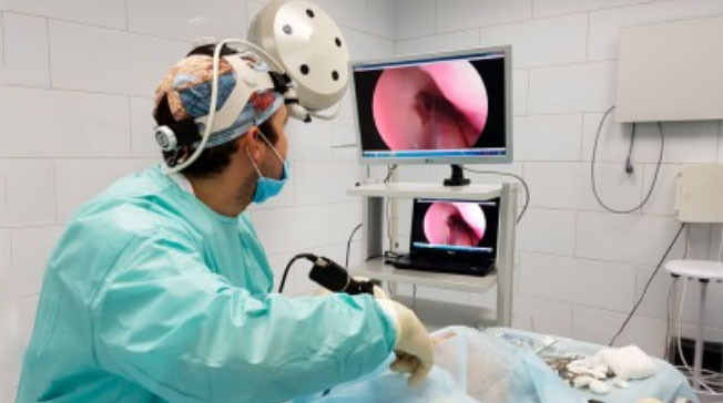 kista-v-nosu-ver…elyustnoj-pazuhi 2 Киста в носу (верхнечелюстной пазухи)