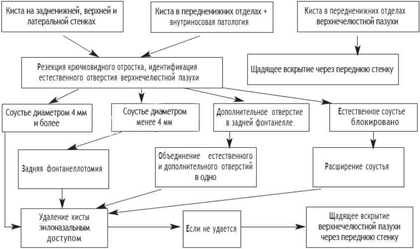 kista-v-nosu-ver…elyustnoj-pazuhi 3 Киста в носу (верхнечелюстной пазухи)