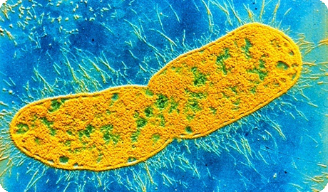 klebsiella bacteria Клебсиелла