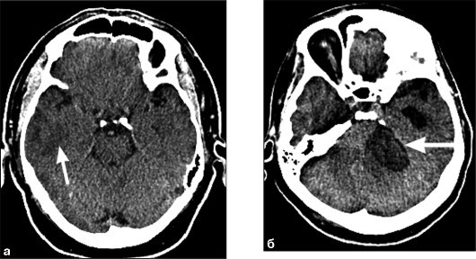 Примеры томограмм Примеры томограмм