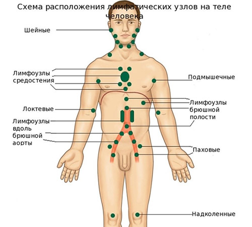 Лимфаденопатия Лимфаденопатия
