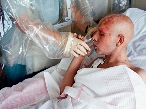 luchevaya-bolezn…henie-radiacziej foto Лучевая болезнь (облучение радиацией)