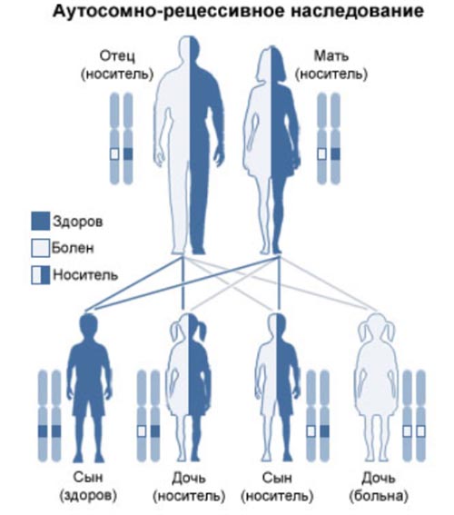 mukovisczidoz-kistoznyj-fibroz nositelstvo Муковисцидоз (кистозный фиброз)