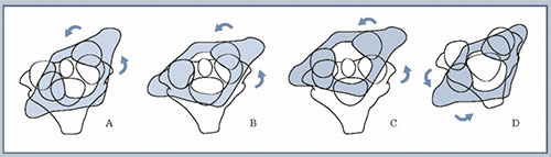 podvyvih-shejnog…podvyvih-atlanta chelust Подвывих шейного позвонка (подвывих атланта)