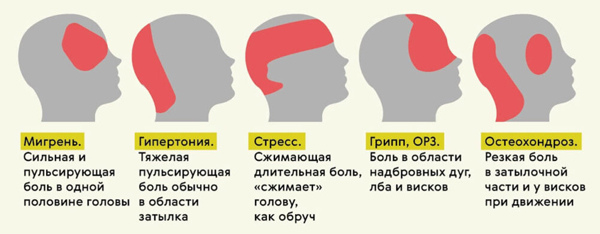 Причины головной боли Причины головной боли