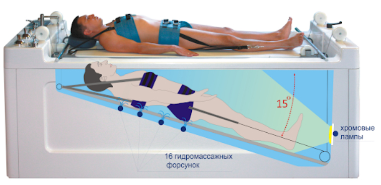 protruziya-diskov-pozvonochnika gidromassag Протрузия дисков позвоночника