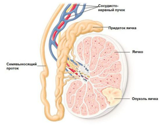 rak-yaichek 1 Рак яичек