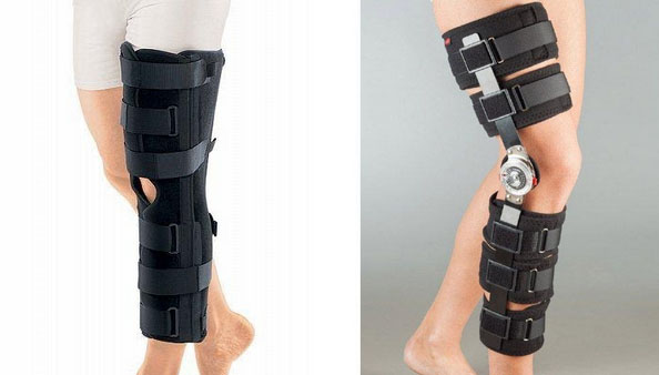 razryv-svyazok lecenie2 Разрыв связок