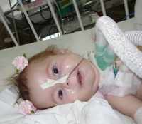 Ребенок со спинальной амиотрофией Верднига-Гоффмана