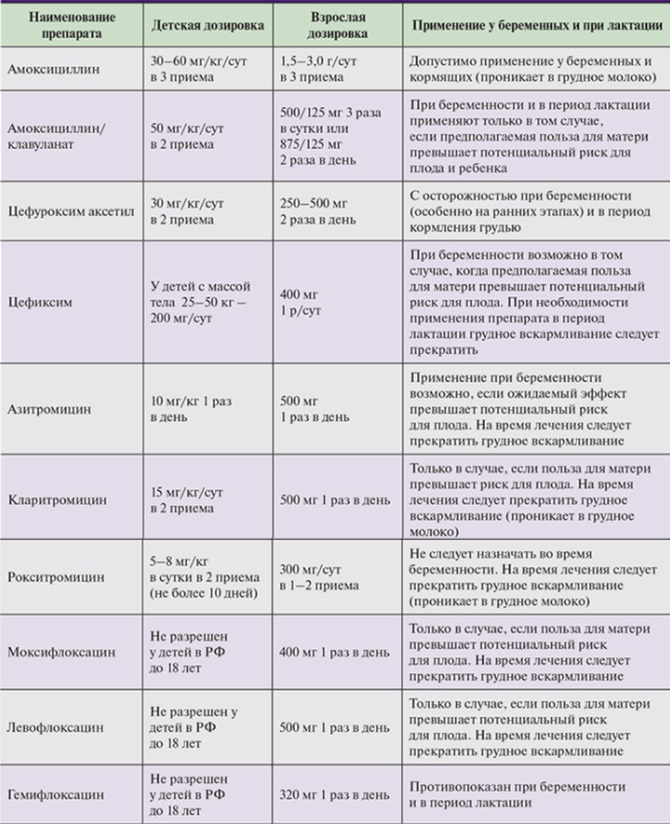 sfenoidit 4 Сфеноидит