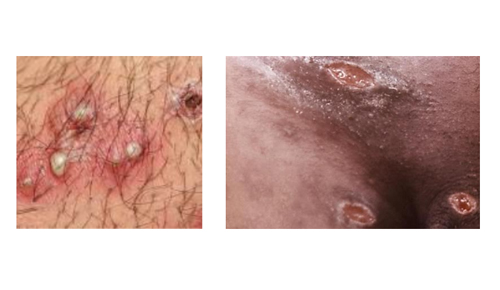 shankr magkiy Шанкр