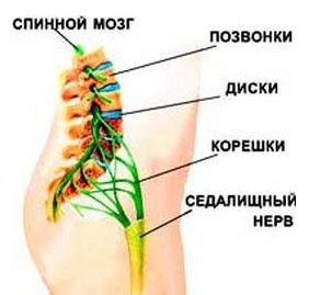 simptom-lasega sxema Симптом Ласега