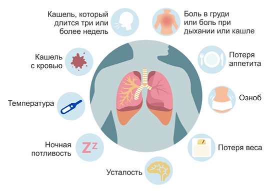Симптомы туберкулеза Симптомы туберкулеза