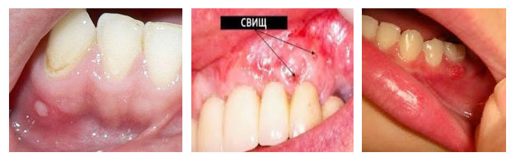 svishh-na-desne foto